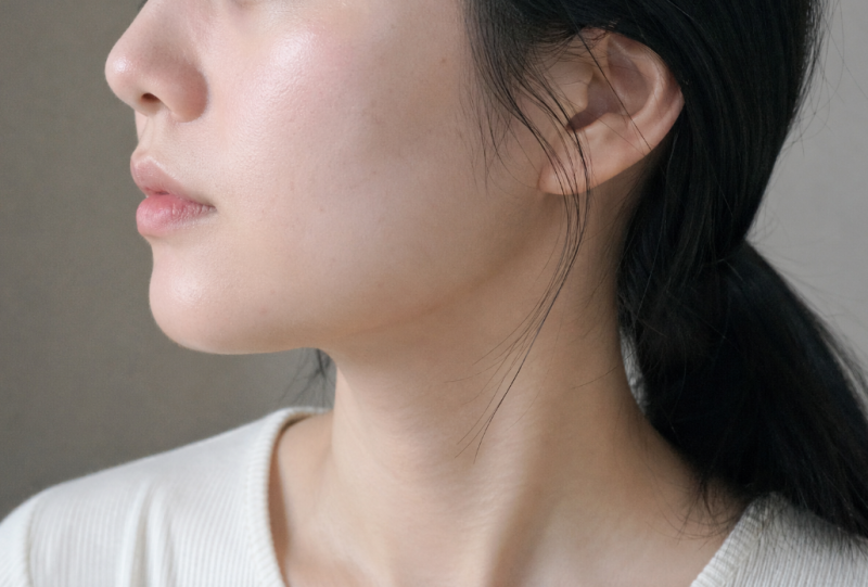 청주울쎄라 얼굴살 적을 때 달라지는 범위 조절