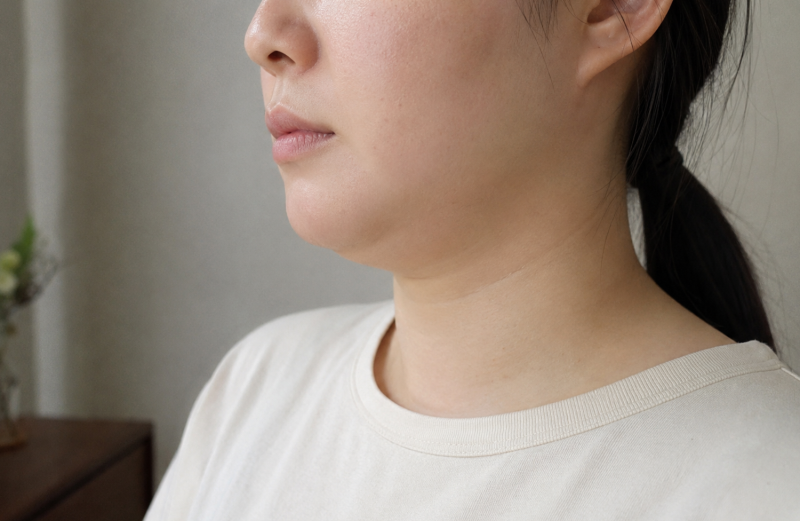 온다리프팅 효과 원리 유지기간 주기까지 <의사작성>
