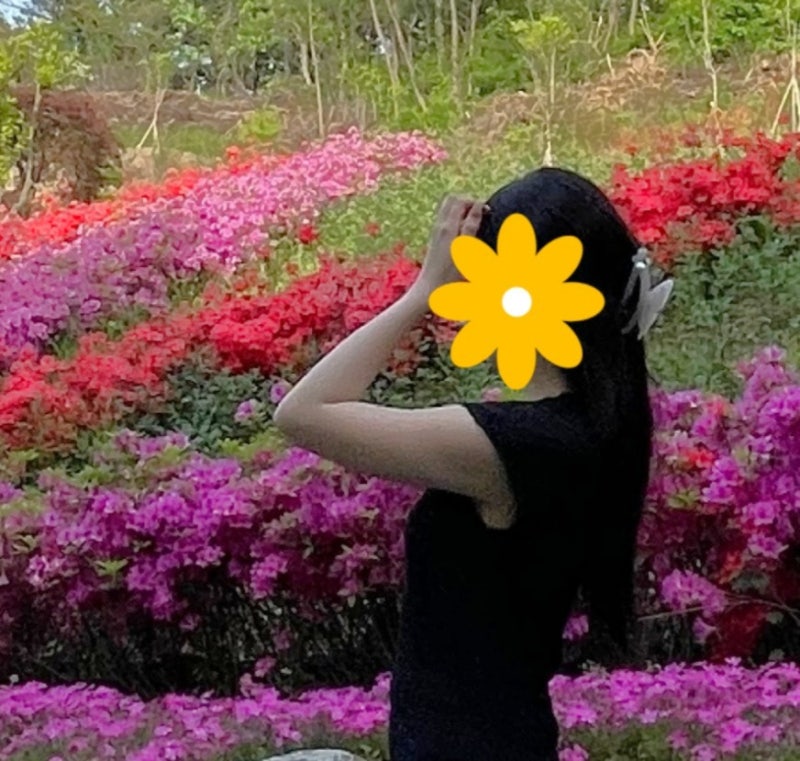 팔뚝살지방흡입 후기 주사 고민하다 결국..<6개월차!>