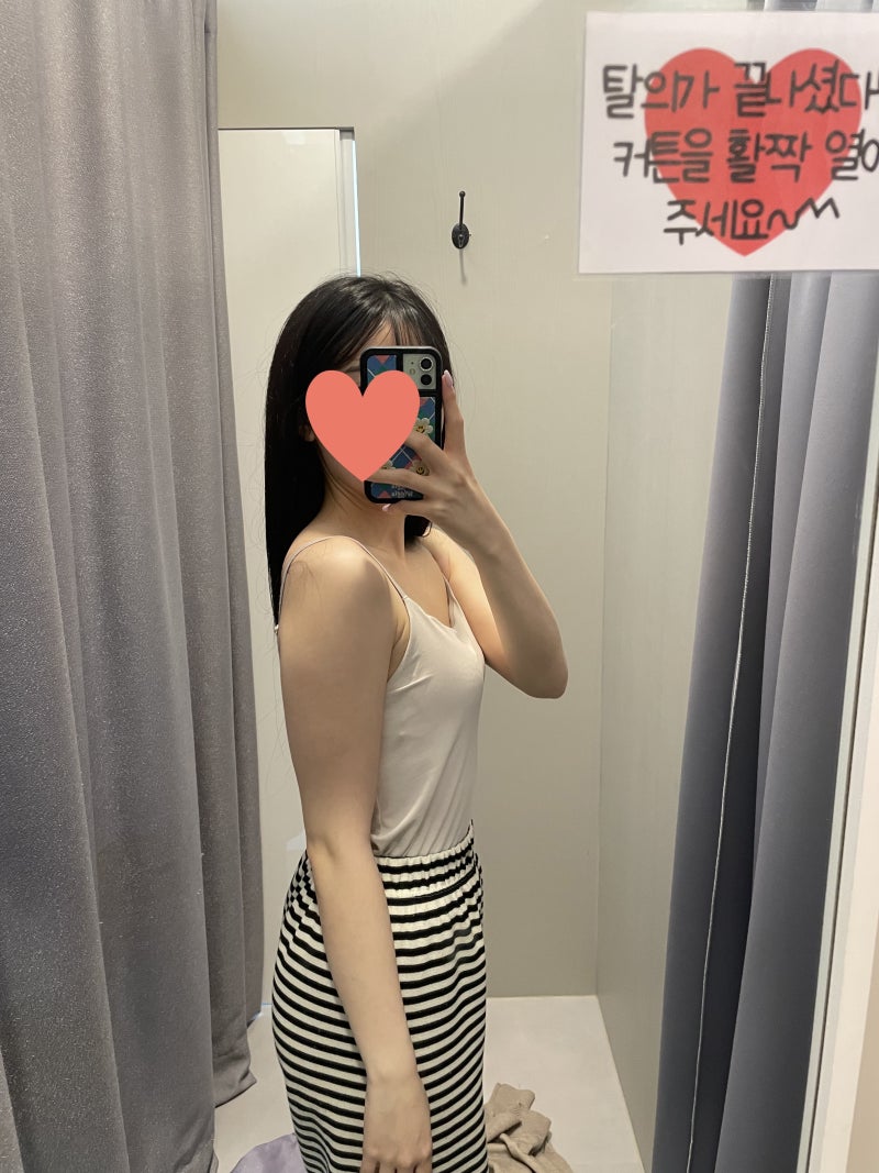 팔뚝살지방흡입 후기 주사 고민하다 결국..<6개월차!>