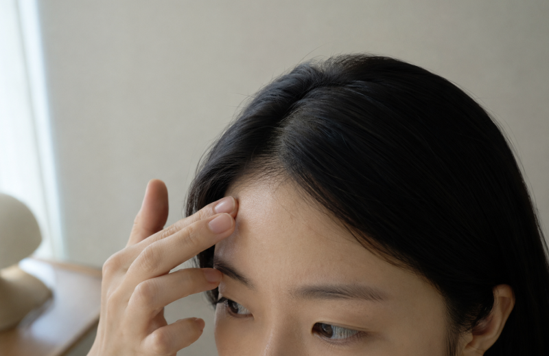 이마필러 부작용 [멍, 울퉁불퉁, 여드름, 염증, 가려움] 피하려면?