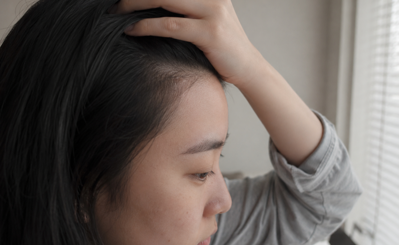 이마필러 부작용 [멍, 울퉁불퉁, 여드름, 염증, 가려움] 피하려면?