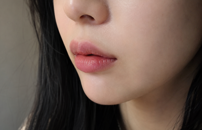 청주입술필러 종류가 아닌 '모양'을 따져야한다?