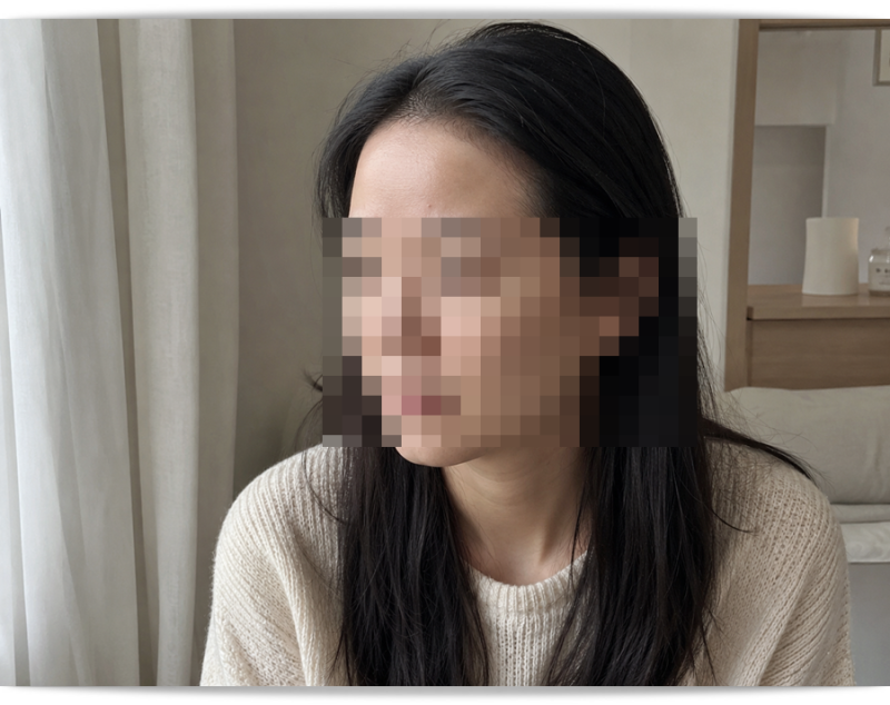 청주이마필러 하나하나 알아보세요<참고>