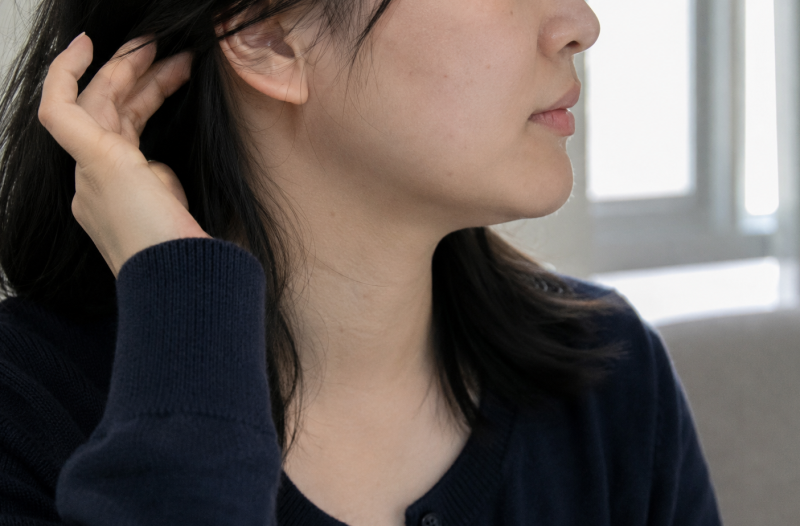 성성동온다리프팅, 샷 수보다 먼저 봐야 할 얼굴의 층