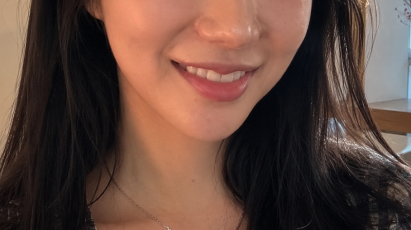 논현 라미네이트 후기 [내돈내산 2편+무삭제]