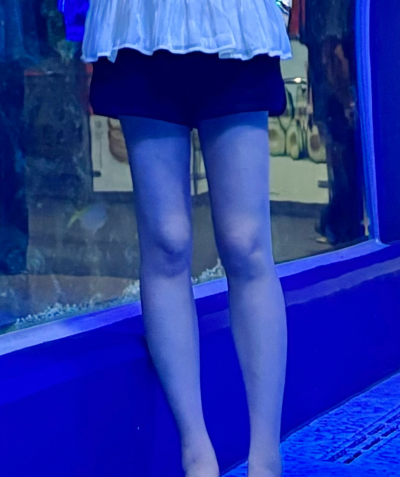 허벅지 지방흡입 가격 & 비용 총정리
