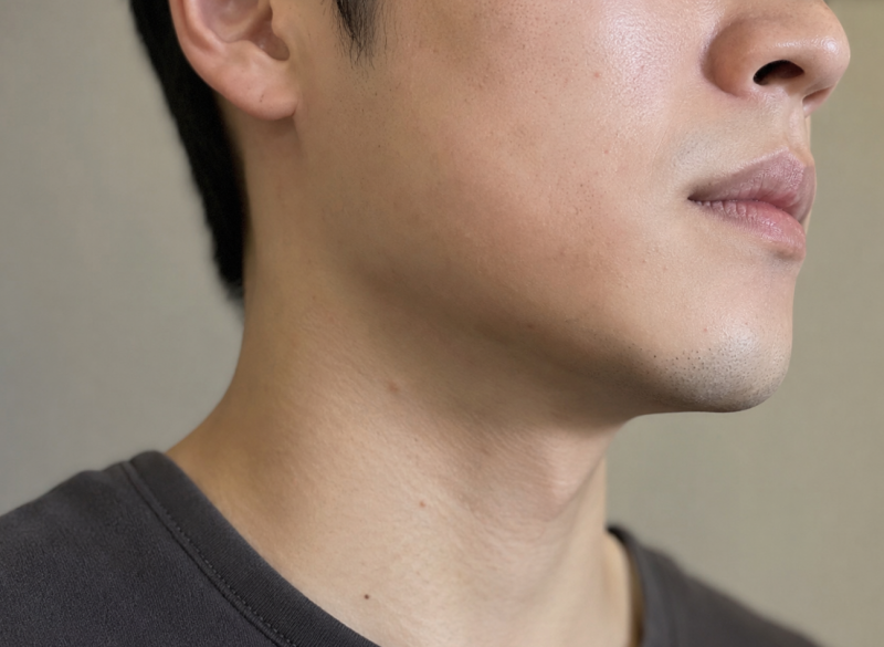 남자사각턱보톡스, 턱 폭보다 먼저 볼 것