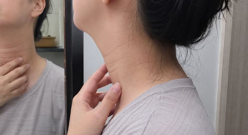 울쎄라 통증, 한달까지 이어질까 걱정된다면