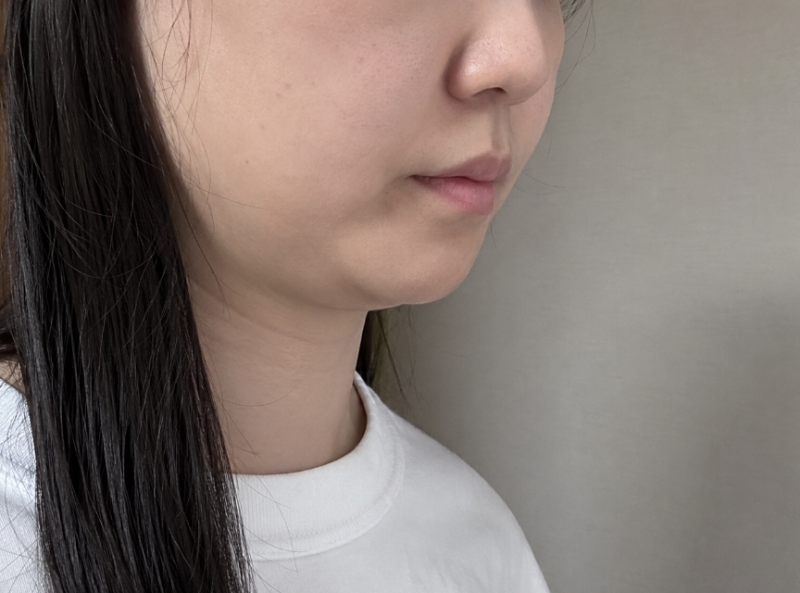 수원슈링크유니버스, 샷 수보다 먼저 볼 얼굴 라인