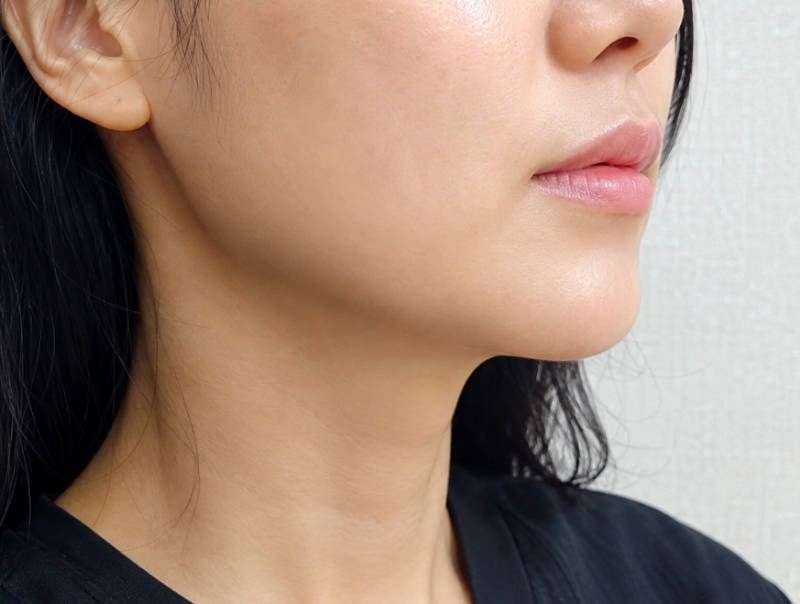 운정 야당역 피부과, 울쎄라·슈링크·써마지 아직 고민이라면?