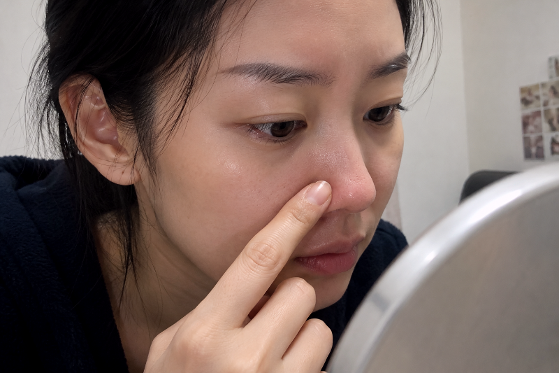 스킨부스터 효과, 종류별 차이부터 가격·부작용·주의사항까지