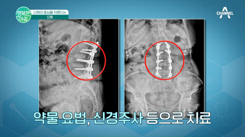 의정부정형외과추천 근골격계 통증에 도수치료