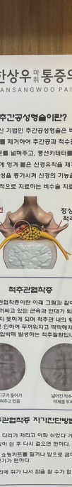 목디스크 가슴통증, 어깨통증 증상 심장질환과 구분법