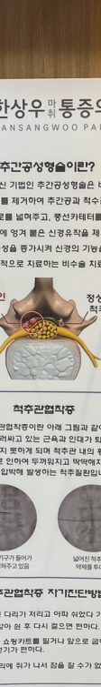양주 정형외과 추천 무릎 통증 치료 진단이 우선