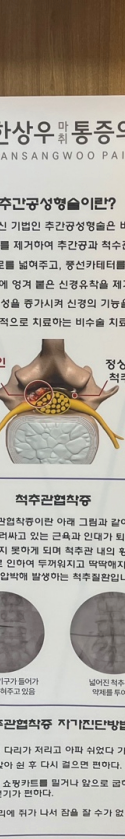 양주허리디스크 통증 정도와 비수술적 관리법 <실제 사례>