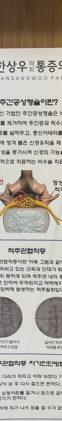 양주정형외과 팔·어깨 통증의 원인과 치료 접근