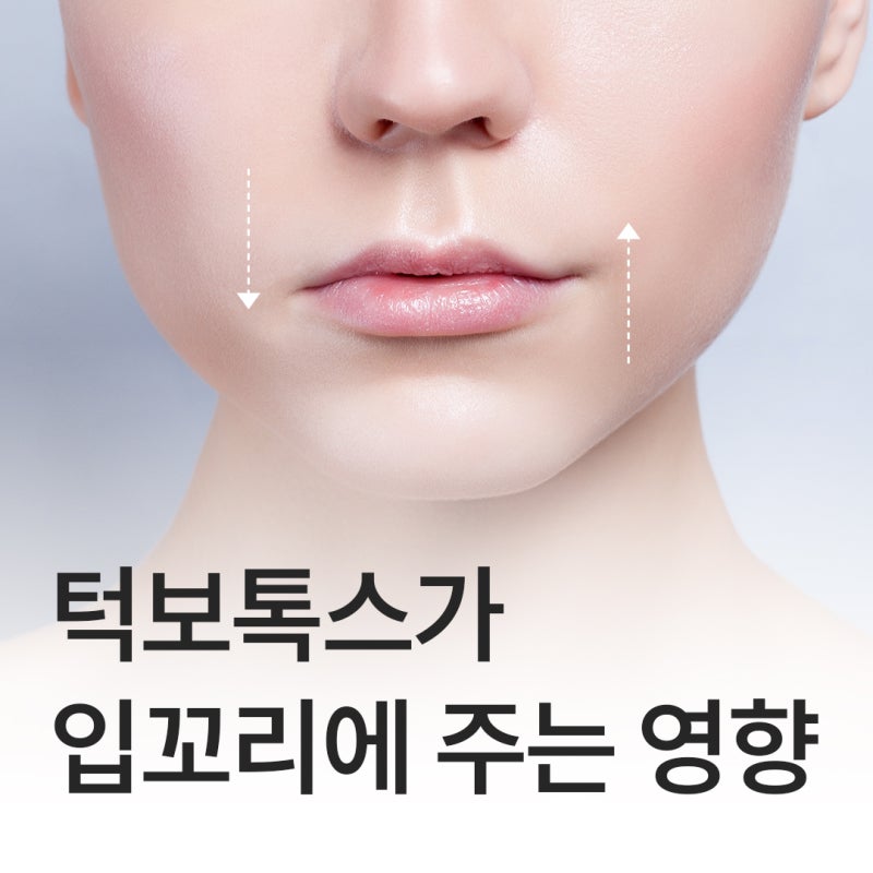 대구동성로턱보톡스 후 웃는 표정이 어색해지는 이유