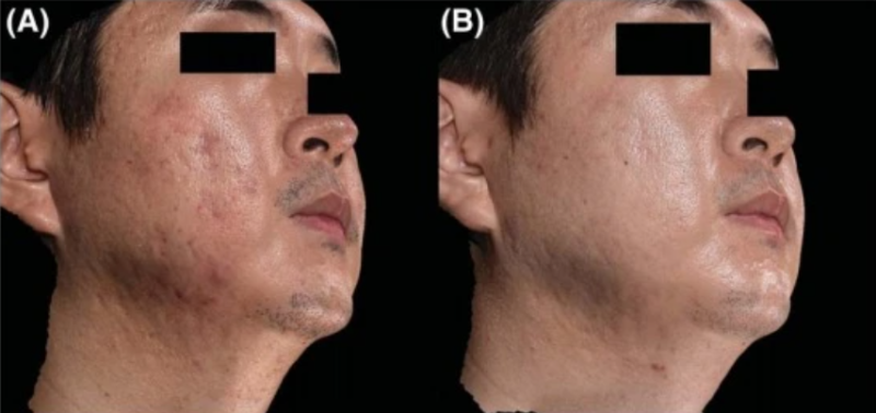 대구포텐자, 같은 장비인데 후기가 다른 이유는 팁에 있습니다