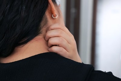 금천구피부과증상 지루성피부염 여드름과 차이점은?