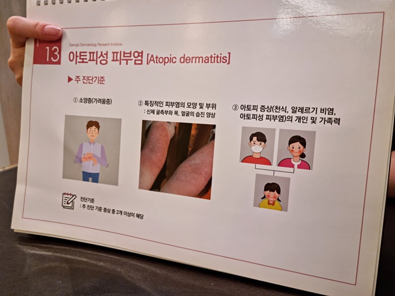 환절기 아토피 초기증상 가볍게 보고 넘기면 안돼