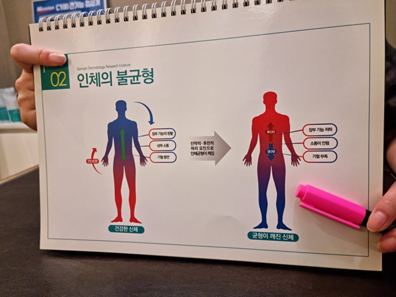 두드러기 원인 갑자기 온몸이 가렵고 부어오르는 이유