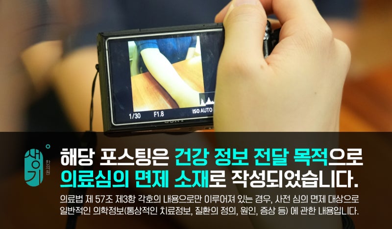 부산 동래피부과질환 아토피 유전 확률은?
