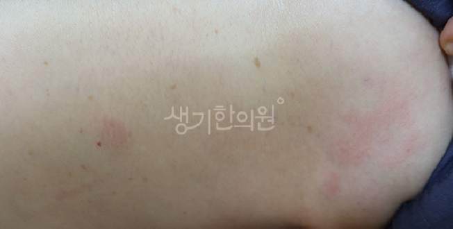 광화문 근처 피부과질환 가려움증 왜 생기는 걸까?