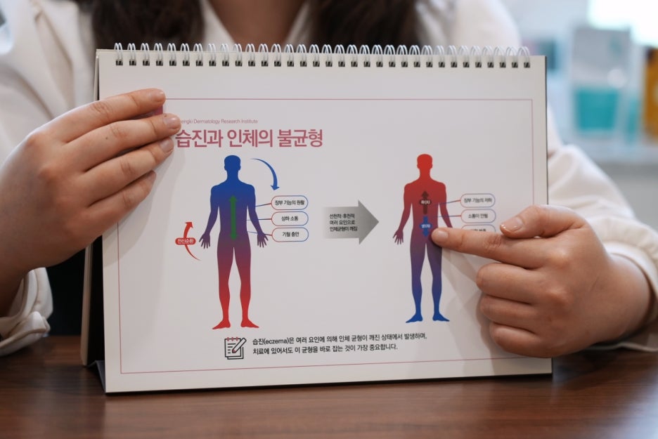영유아 습진 원인 침 흘림과 기저귀 마찰로 빨개진 아기 피부 보호