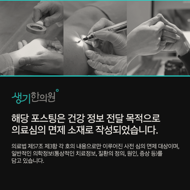 두드러기가 반복되는 환자에게 알레르기 유발 물질 회피 전략이 현실적으로 어려운 이유