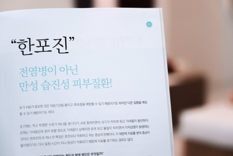 한포진 연고 치료에도 효과가 느껴지지 않는다면