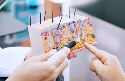 동전 모양 화폐상습진 치료 방법 이렇게 해보세요