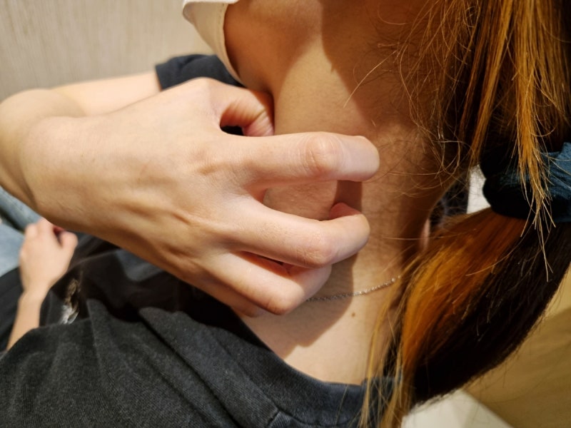 덕천피부과질환 여드름 부위별 원인에 따라 접근해야