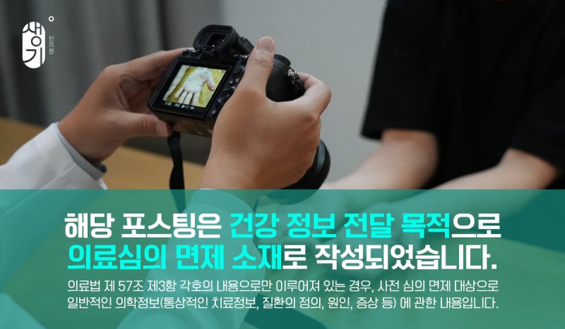 건선 크림, 로션, 연고 다 해봐도 안될 땐