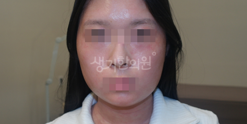 피부아토피 총정리 : 원인, 증상, 치료법