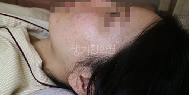 눈가 사마귀 화장품 자극과 손으로 만지는 습관의 위험성