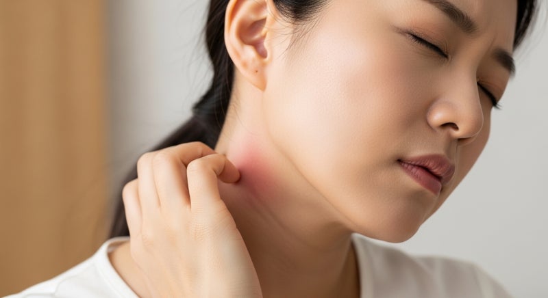편평사마귀 치료 시기를 놓치면 얼굴 전체로 퍼질 수 있어