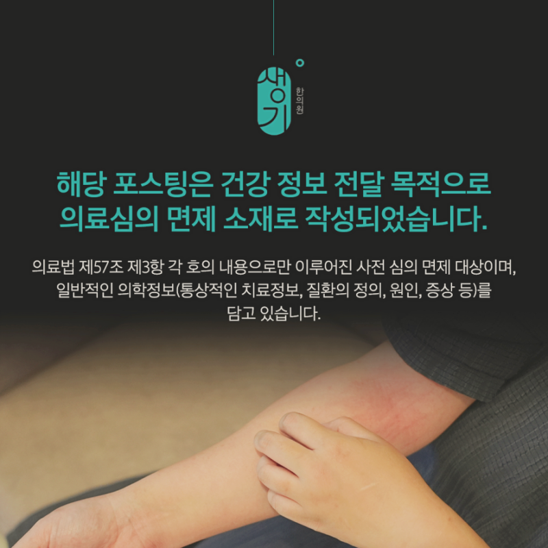 동탄지루성두피염 기름짐 각질 여름에 심해진다면