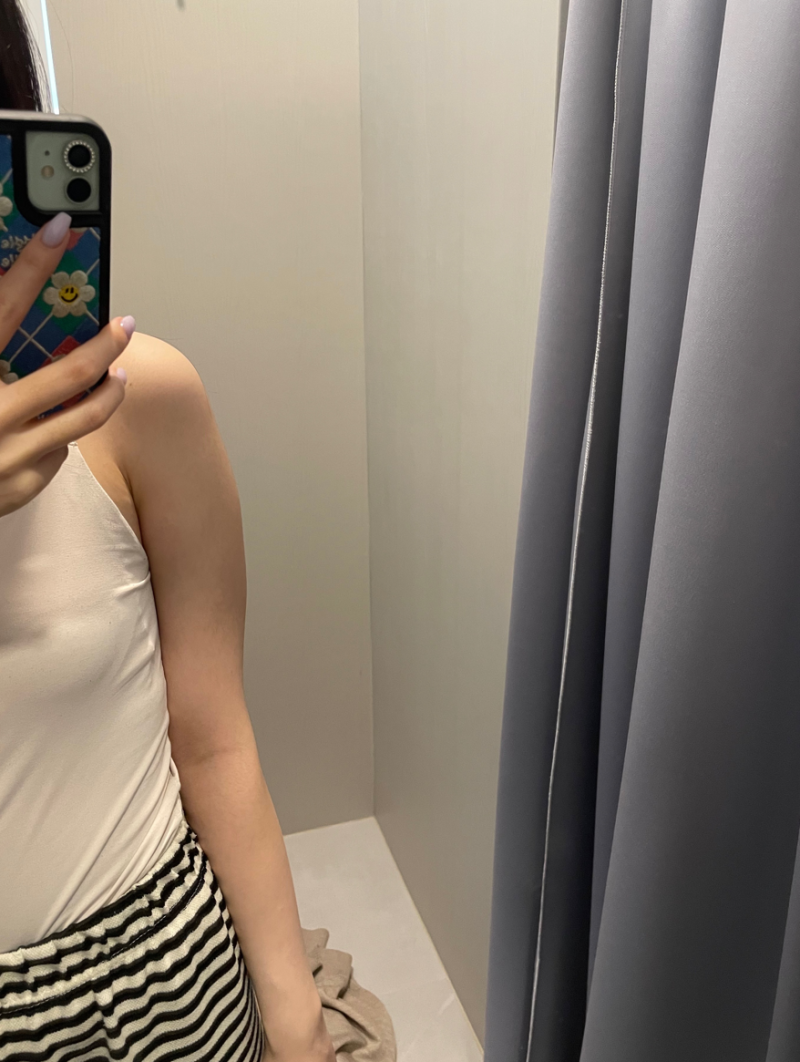 팔 지방흡입 통증 얼마나 심할까?