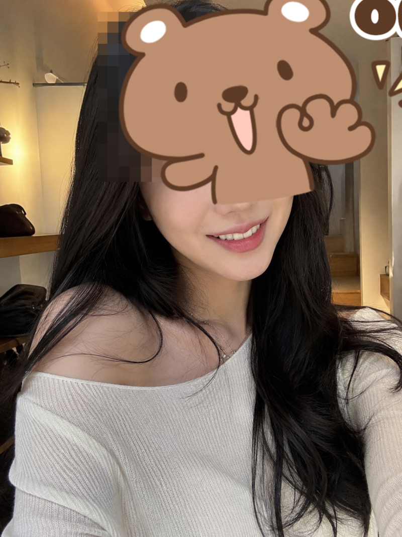 치아미백 라미네이트로 받다.[6주차 후기]