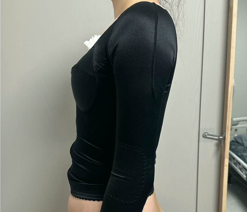 팔 겨드랑이 부유방 지흡 실제후기 완전 대만족 중!!