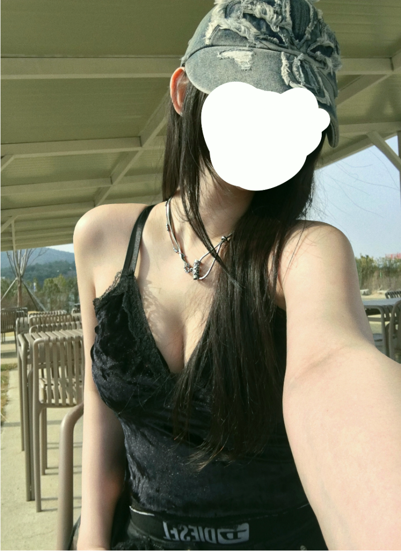 팔 겨드랑이 부유방 지흡 실제후기 완전 대만족 중!!